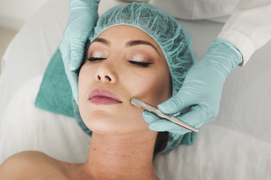 A diamond-peel skin treatment